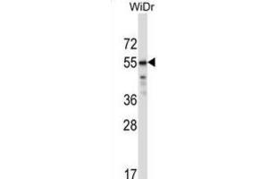 Western Blotting (WB) image for anti-Transcription Factor CP2-Like 1 (TFCP2L1) antibody (ABIN2997307) (TFCP2L1 抗体)