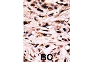 Immunohistochemistry (IHC) image for anti-SMAD Family Member 4 (SMAD4) (pThr277) antibody (ABIN3001788) (SMAD4 抗体  (pThr277))