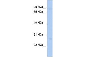 WB Suggested Anti-TLE4 Antibody Titration:  0. (TLE4 抗体  (N-Term))