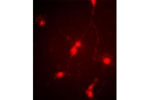Immunofluorescence image of cultured chick retinal amacrine (neuronal) cells labeled with CLC4 Antibody (C-term). (CLCN4 抗体  (C-Term))