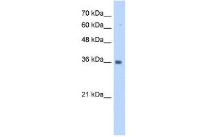 TRUB2 antibody used at 1 ug/ml to detect target protein. (TRUB2 抗体  (N-Term))