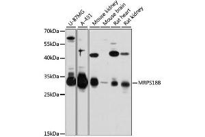 Western blot analysis of extracts of various cell lines, using MRPS18B antibody (ABIN6293873) at 1:3000 dilution. (MRPS18B 抗体)