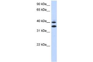 WB Suggested Anti-SLC25A32 Antibody Titration:  0. (SLC25A32 抗体  (Middle Region))