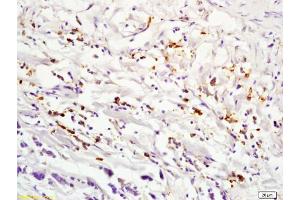 Immunohistochemistry (IHC) image for anti-Interleukin 2 Receptor, alpha (IL2RA) (AA 201-268) antibody (ABIN670371)