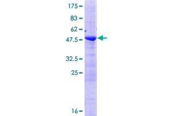 ZMAT2 Protein (AA 1-199) (GST tag)