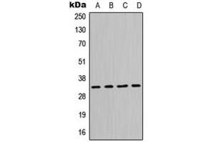 Western blot analysis of MPG expression in Jurkat (A), HeLa (B), Raw264. (MPG 抗体  (N-Term))