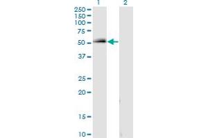 Western Blot analysis of SPP1 expression in transfected 293T cell line by SPP1 monoclonal antibody (M16), clone 1D7. (Osteopontin 抗体  (AA 21-129))