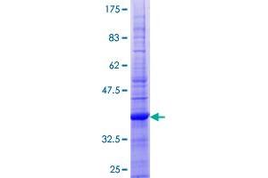 CD59 Protein (CD59) (AA 1-128) (GST tag)