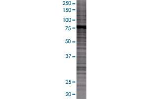 Western Blotting (WB) image for VIL2 293T Cell Transient Overexpression Lysate(Denatured) (ABIN1333885)