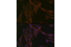 Immunofluorescence analysis of C6 cells using DDX6 Rabbit mAb (ABIN7266703) at dilution of 1:100 (40x lens). (DDX6 抗体)