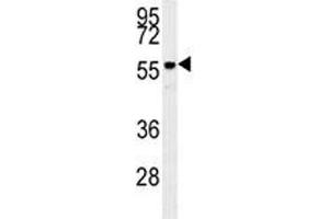 Anti-AKT2 antibody western blot analysis in mouse brain tissue lysate (AKT2 抗体)