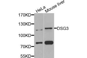 Western blot analysis of extracts of various cell lines, using DSG3 antibody (ABIN5974847) at 1/1000 dilution. (Desmoglein 3 抗体)