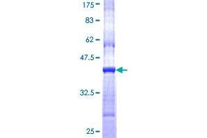 Image no. 1 for Cholinergic Receptor, Nicotinic, delta (Muscle) (CHRND) (AA 24-130) protein (GST tag) (ABIN1349419) (CHRND Protein (AA 24-130) (GST tag))