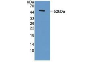 Detection of Recombinant LAMC3, Human using Polyclonal Antibody to Laminin Gamma 3 (LAMC3) (LAMC3 抗体  (AA 901-1100))