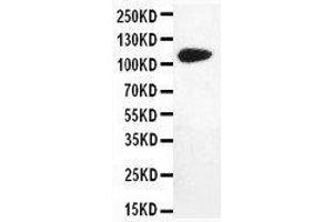 Anti-DPYD antibody, Western blotting WB: MM231 Cell Lysate (DPYD 抗体  (N-Term))