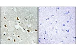 Immunohistochemistry analysis of paraffin-embedded human brain tissue, using IRS-1 (Ab-636) Antibody. (IRS1 抗体  (AA 603-652))