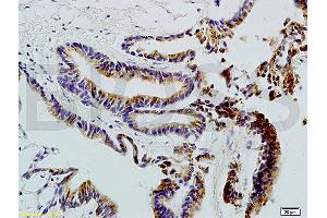 Formalin-fixed and paraffin embedded rat colon carcinoma labeled with Anti-CD20 Polyclonal Antibody , Unconjugated 1:200 followed by conjugation to the secondary antibody and DAB staining (CD20 抗体  (AA 133-182))