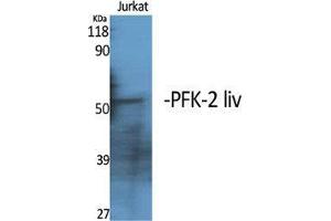 Western Blot (WB) analysis of specific cells using PFK-2 liv Polyclonal Antibody. (PFK-2 LIV (C-Term) 抗体)