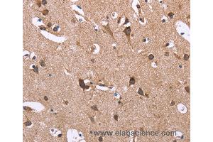 Immunohistochemistry of Human brain  using SERPINA1 Polyclonal Antibody at dilution of 1:30 (SERPINA1 抗体)