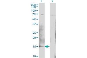 Western Blot analysis of BTG2 expression in transfected 293T cell line by BTG2 monoclonal antibody (M02), clone 1B8. (BTG2 抗体  (AA 59-158))