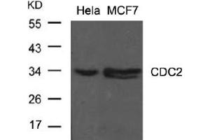 Image no. 2 for anti-Cyclin-Dependent Kinase 1 (CDK1) (Tyr15) antibody (ABIN197483) (CDK1 抗体  (Tyr15))