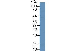 Western blot analysis of Human K562 cell lysate, using Mouse CDK2 Antibody (2 µg/ml) and HRP-conjugated Goat Anti-Rabbit antibody ( (CDK2 抗体  (AA 93-211))