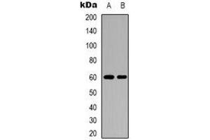 Western blot analysis of Importin alpha 2 expression in mouse heart (A), mouse brain (B) whole cell lysates. (KPNA2 抗体  (N-Term))