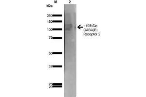 Western Blot analysis of Rat Brain Membrane showing detection of ~105 kDa GABA B Receptor 2 protein using Mouse Anti-GABA B Receptor 2 Monoclonal Antibody, Clone S81-2 . (GABBR2 抗体  (AA 861-912) (APC))
