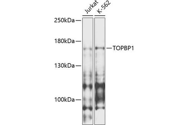 TOPBP1 抗体  (AA 1-100)