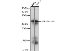 Western blot analysis of extracts of various cell lines, using HSP27/HSPB1Rabbit mAb (ABIN7267569) at 1:1000 dilution. (HSP27 抗体)