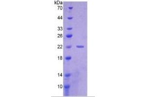 SDS-PAGE (SDS) image for Cytokeratin Fragment Antigen 21-1 (CYFRA21.1) ELISA Kit (ABIN6574267)