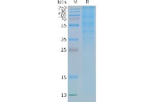 Human R-Nanodisc, Flag Tag on SDS-PAGE (GLP1R 蛋白)