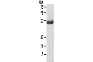 Western Blotting (WB) image for anti-1-Acylglycerol-3-Phosphate O-Acyltransferase 6 (Lysophosphatidic Acid Acyltransferase, Zeta) (AGPAT6) antibody (ABIN2427468) (AGPAT6 抗体)