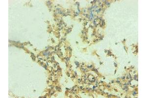 Immunohistochemical of paraffin-embedded human lung tissue using ABIN7168560 at dilution of 1:200 (S1A9 抗体)