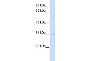 WB Suggested Anti-PVRIG Antibody Titration:  0. (PVRIG 抗体  (Middle Region))