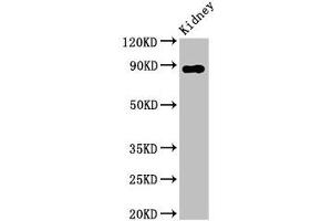 Western Blot Positive WB detected in: Rat kidney tissue All lanes: DPP4 antibody at 2. (DPP4 抗体  (AA 473-588))