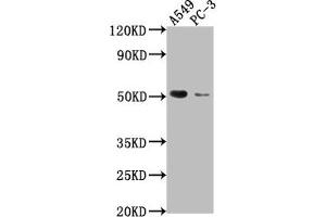 Western Blot Positive WB detected in: A549 whole cell lysate, PC-3 whole cell lysate All lanes: TNFRSF1A antibody at 1:2000 Secondary Goat polyclonal to rabbit IgG at 1/50000 dilution Predicted band size: 51, 39, 26, 25 kDa Observed band size: 51 kDa (TNFRSF1A 抗体  (AA 249-455))