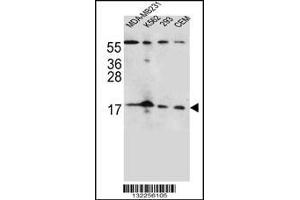Western blot analysis in MDA-MB231,K562,293,CEM cell line lysates (35ug/lane). (FGF22 抗体  (N-Term))
