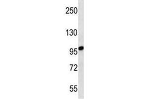 STIM2 antibody western blot analysis in uterus tumor lysate. (Stim2 抗体  (AA 98-127))