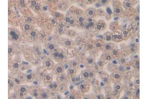 DAB staining on IHC-P; Samples: Mouse Liver Tissue (CCL4 抗体  (AA 24-92))