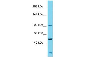 Host: Rabbit Target Name: PALD1 Sample Type: HepG2 Whole Cell lysates Antibody Dilution: 1. (KIAA1274 抗体  (N-Term))