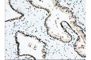 Immunohistochemical staining of paraffin-embedded Human Kidney tissue using anti-USP5 mouse monoclonal antibody. (USP5 抗体)