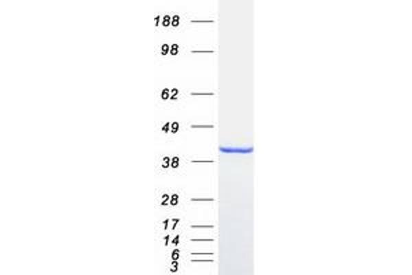 ABHD5 Protein (Myc-DYKDDDDK Tag)