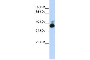 Western Blotting (WB) image for anti-Aldolase B, Fructose-Bisphosphate (ALDOB) antibody (ABIN2458580) (ALDOB 抗体)