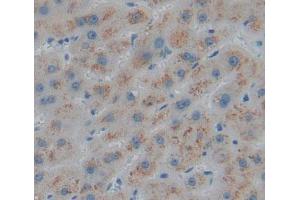 Used in DAB staining on fromalin fixed paraffin- embedded liver tissue (HMGCL 抗体  (AA 1-325))