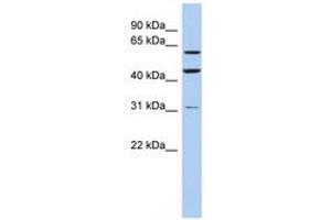 Image no. 1 for anti-Ring Finger Protein 112 (RNF112) (AA 466-515) antibody (ABIN6742431) (RNF112 抗体  (AA 466-515))