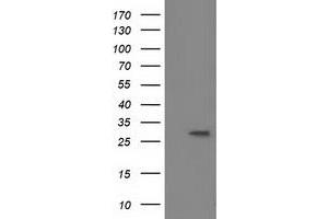Western Blotting (WB) image for anti-Bridging Integrator 3 (BIN3) antibody (ABIN1496924) (BIN3 抗体)