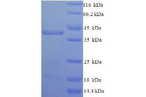 SDS-PAGE (SDS) image for Syndecan 1 (SDC1) (AA 23-254), (Extracellular) protein (His-SUMO Tag) (ABIN5710320) (Syndecan 1 Protein (SDC1) (AA 23-254, Extracellular) (His-SUMO Tag))