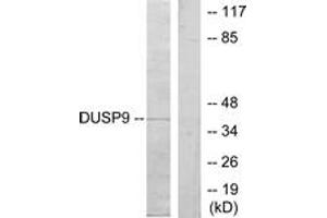 Western blot analysis of extracts from HeLa cells, using DUSP9 Antibody. (DUSP9 抗体  (AA 151-200))