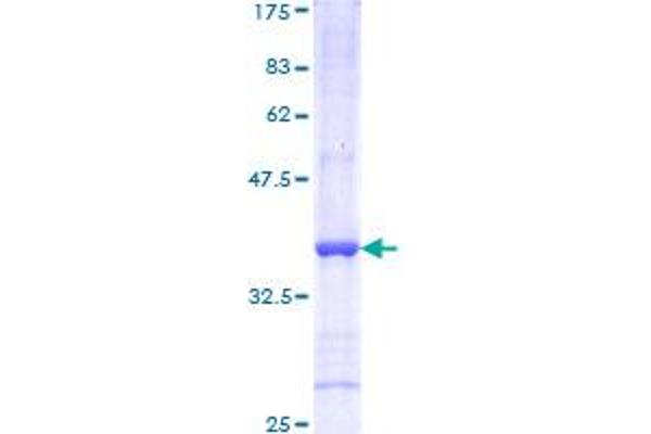 Ret Proto-Oncogene Protein (RET) (AA 361-458) (GST tag)